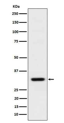 Anti-BCL2L12 Rabbit Monoclonal Antibody Boster Bio