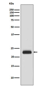 Anti-RAIDD Rabbit Monoclonal Antibody Boster Bio