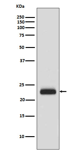 Anti-RAIDD Rabbit Monoclonal Antibody Boster Bio