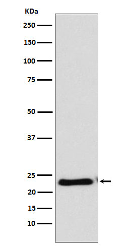 Anti-RAIDD Rabbit Monoclonal Antibody Boster Bio