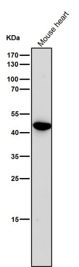 Anti-Uroplakin3a UPK3A Monoclonal Antibody Boster Bio