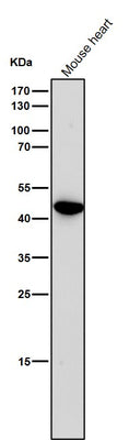 Anti-Uroplakin3a UPK3A Monoclonal Antibody Boster Bio