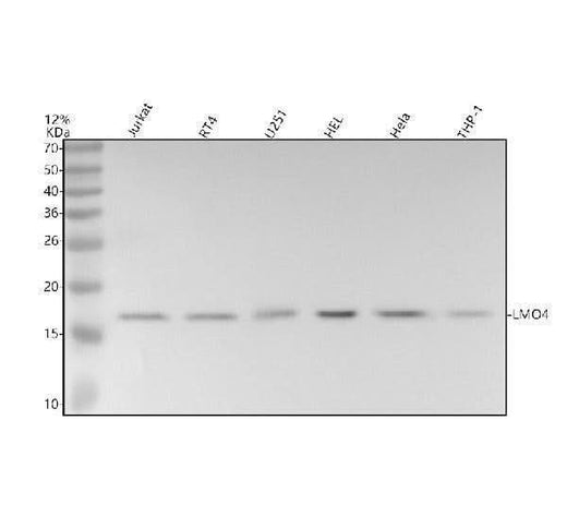 Anti-LMO4 Rabbit Monoclonal Antibody Boster Bio