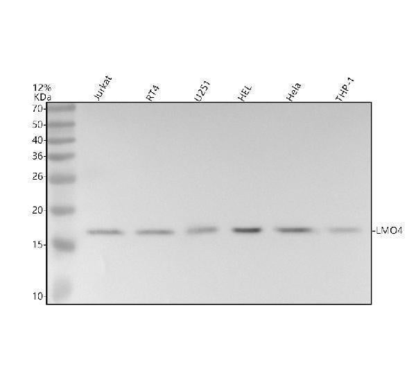 Anti-LMO4 Rabbit Monoclonal Antibody Boster Bio