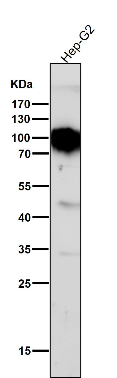 Anti-TGN46 Rabbit Monoclonal Antibody Boster Bio