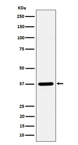 Anti-Syntaxin 16 Rabbit Monoclonal Antibody Boster Bio