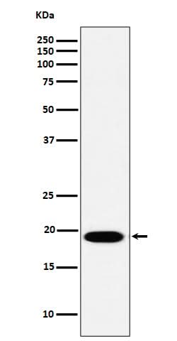 Anti-MSRB3 Rabbit Monoclonal Antibody Boster Bio
