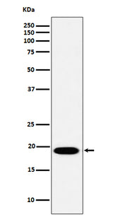 Anti-MSRB3 Rabbit Monoclonal Antibody Boster Bio