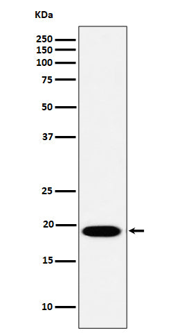 Anti-MSRB3 Rabbit Monoclonal Antibody Boster Bio