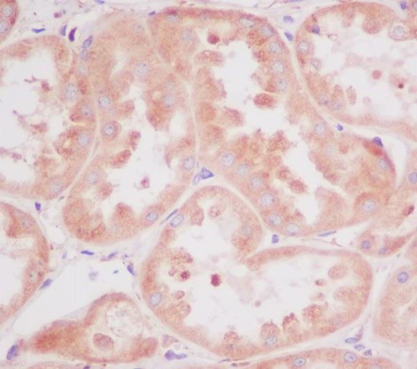 Anti-RPS20/Ribosomal Protein S20 Rabbit Monoclonal Antibody Boster Bio