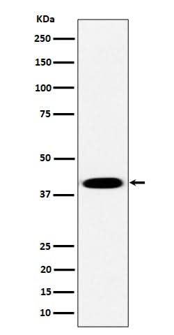 Anti-Pleckstrin Rabbit Monoclonal Antibody Boster Bio