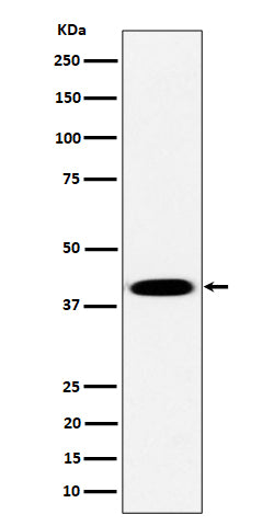Anti-Pleckstrin Rabbit Monoclonal Antibody Boster Bio