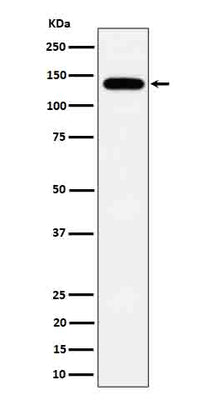 Anti-Tripeptidyl peptidase II Rabbit Monoclonal Antibody Boster Bio