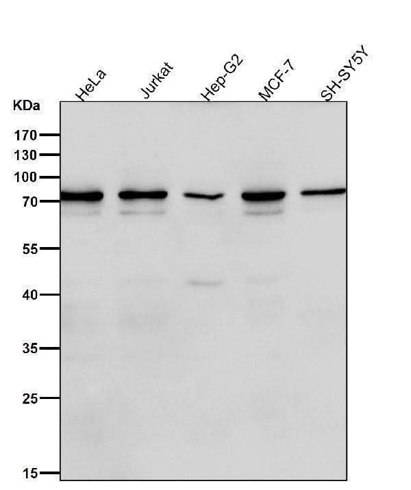 Anti-Frizzled 8 Rabbit Monoclonal Antibody Boster Bio