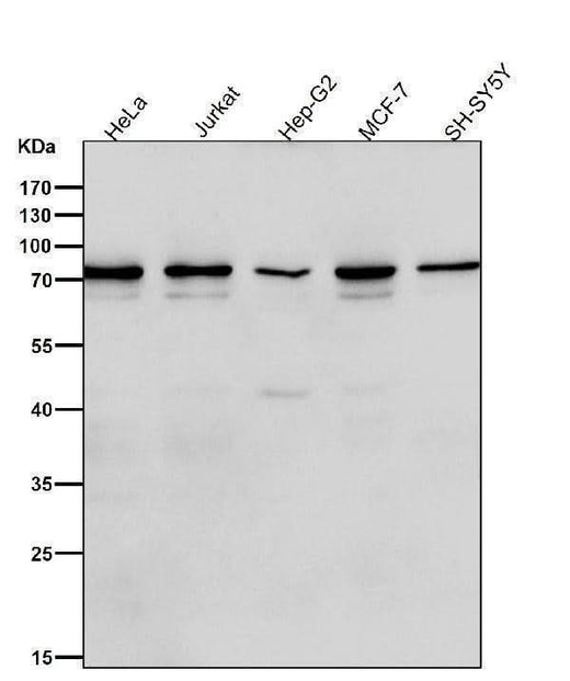 Anti-Frizzled 8 Rabbit Monoclonal Antibody Boster Bio