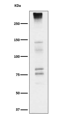 Anti-Neurocan Rabbit Monoclonal Antibody Boster Bio