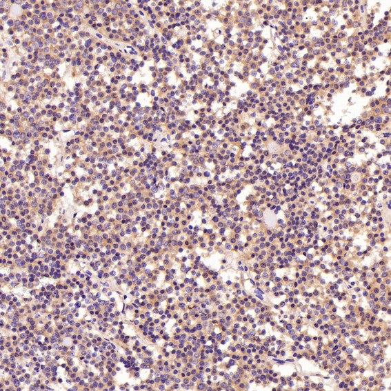 Anti-PI 3 Kinase p55 gamma PIK3R3 Rabbit Monoclonal Antibody Boster Bio