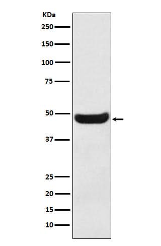 Anti-BHMT Rabbit Monoclonal Antibody Boster Bio