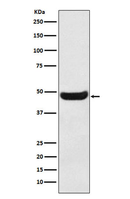 Anti-BHMT Rabbit Monoclonal Antibody Boster Bio