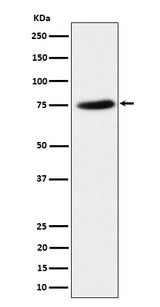 Anti-PPM1G Rabbit Monoclonal Antibody Boster Bio