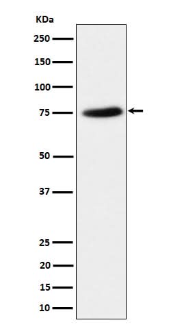 Anti-PPM1G Rabbit Monoclonal Antibody Boster Bio
