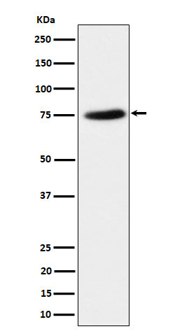 Anti-PPM1G Rabbit Monoclonal Antibody Boster Bio