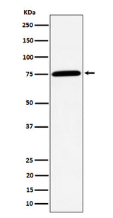 Anti-PPM1G Rabbit Monoclonal Antibody Boster Bio