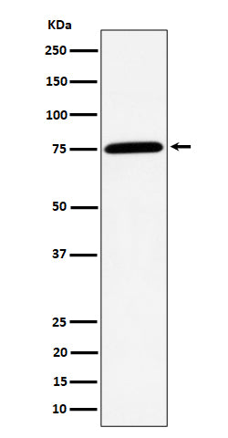 Anti-PPM1G Rabbit Monoclonal Antibody Boster Bio