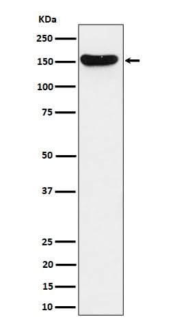 Anti-HDLBP Rabbit Monoclonal Antibody Boster Bio