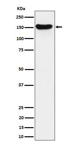 Anti-HDLBP Rabbit Monoclonal Antibody Boster Bio