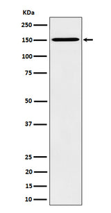 Anti-HDLBP Rabbit Monoclonal Antibody Boster Bio