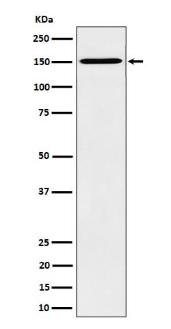 Anti-HDLBP Rabbit Monoclonal Antibody Boster Bio