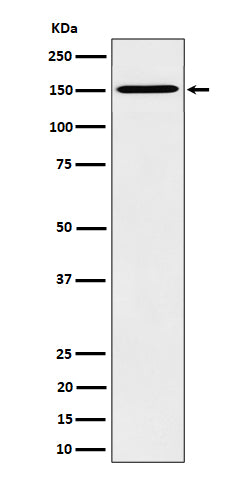 Anti-HDLBP Rabbit Monoclonal Antibody Boster Bio