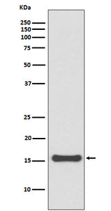 Anti-SUMO4 Rabbit Monoclonal Antibody Boster Bio