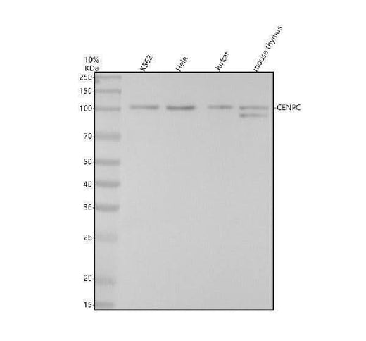 Anti-CENPC Rabbit Monoclonal Antibody Boster Bio