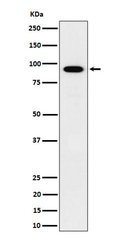 Anti-IFT88 Rabbit Monoclonal Antibody Boster Bio