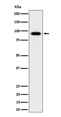 Anti-IFT88 Rabbit Monoclonal Antibody Boster Bio