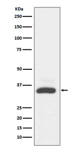 Anti-MAD2L1BP/Mad2L1 Binding Protein Rabbit Monoclonal Antibody Boster Bio