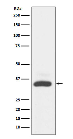 Anti-MAD2L1BP/Mad2L1 Binding Protein Rabbit Monoclonal Antibody Boster Bio