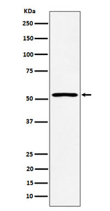 Anti-SAMM50 Rabbit Monoclonal Antibody Boster Bio