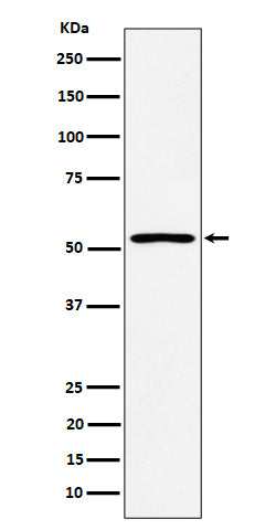 Anti-SAMM50 Rabbit Monoclonal Antibody Boster Bio