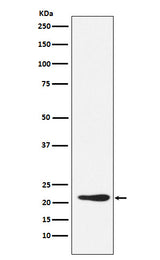 Anti-GDF3 Rabbit Monoclonal Antibody Boster Bio