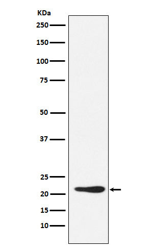 Anti-GDF3 Rabbit Monoclonal Antibody Boster Bio