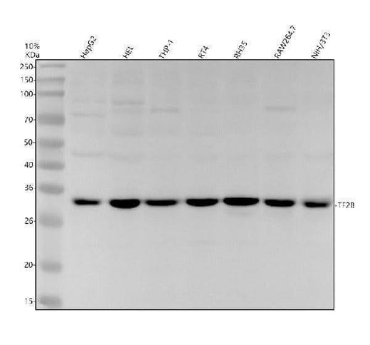 Anti-TF2B Rabbit Monoclonal Antibody Boster Bio