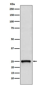 Anti-TC10 Rabbit Monoclonal Antibody Boster Bio
