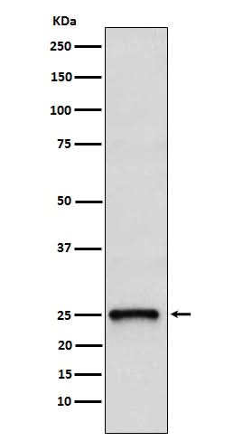 Anti-TC10 Rabbit Monoclonal Antibody Boster Bio