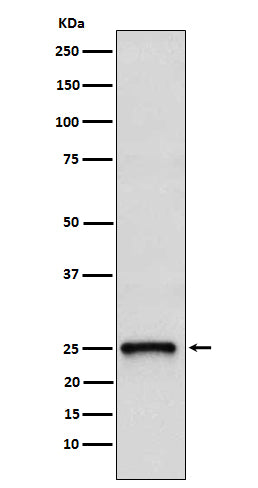 Anti-TC10 Rabbit Monoclonal Antibody Boster Bio