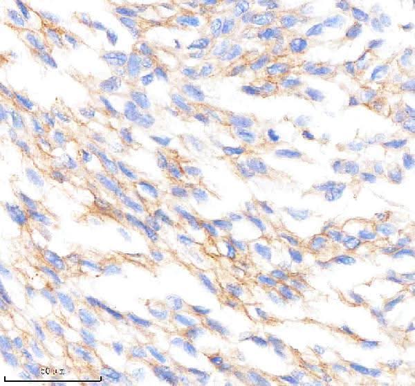 Anti-PTPRR Rabbit Monoclonal Antibody Boster Bio