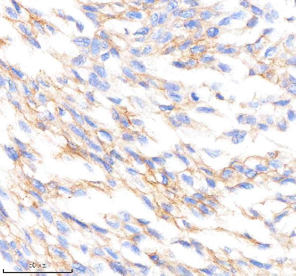Anti-PTPRR Rabbit Monoclonal Antibody Boster Bio