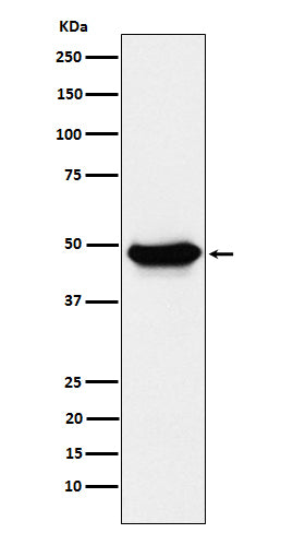 Anti-ENTPD5 Rabbit Monoclonal Antibody Boster Bio